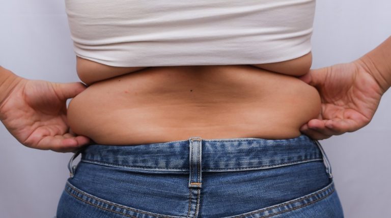 لاغری موضعی