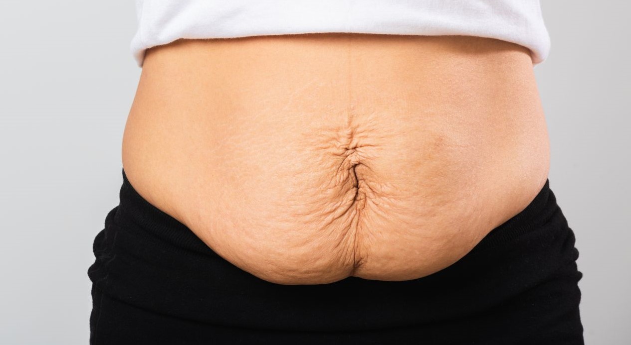 علت چاقی - کاهش وزن در طب سنتی