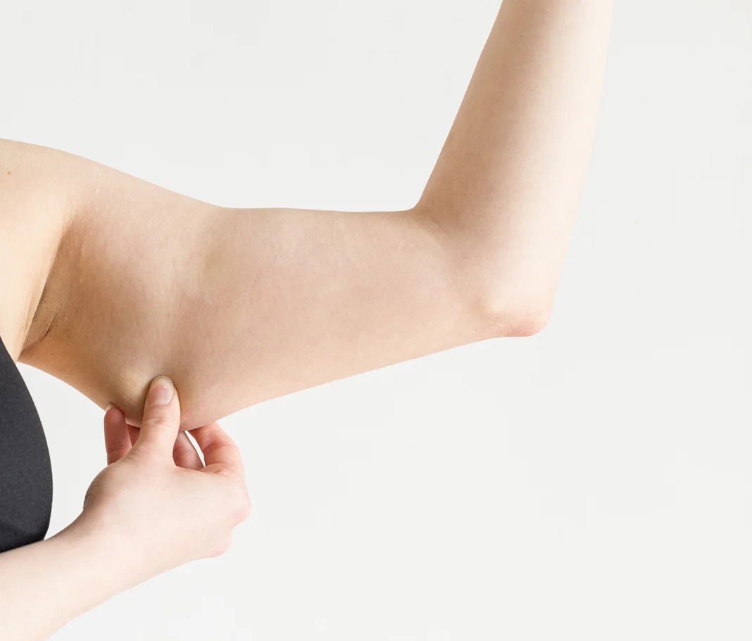 افتادگی بازو - لاغری موضعی