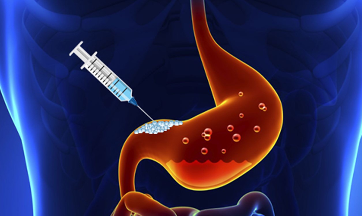 مراقبت های بعد از بوتاکس معده