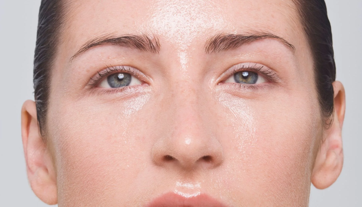 چربی پوست - علت چرب شدن پوست صورت