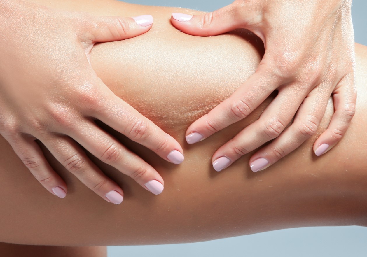 رفع سلولیت پا - درمان سلولیت ران