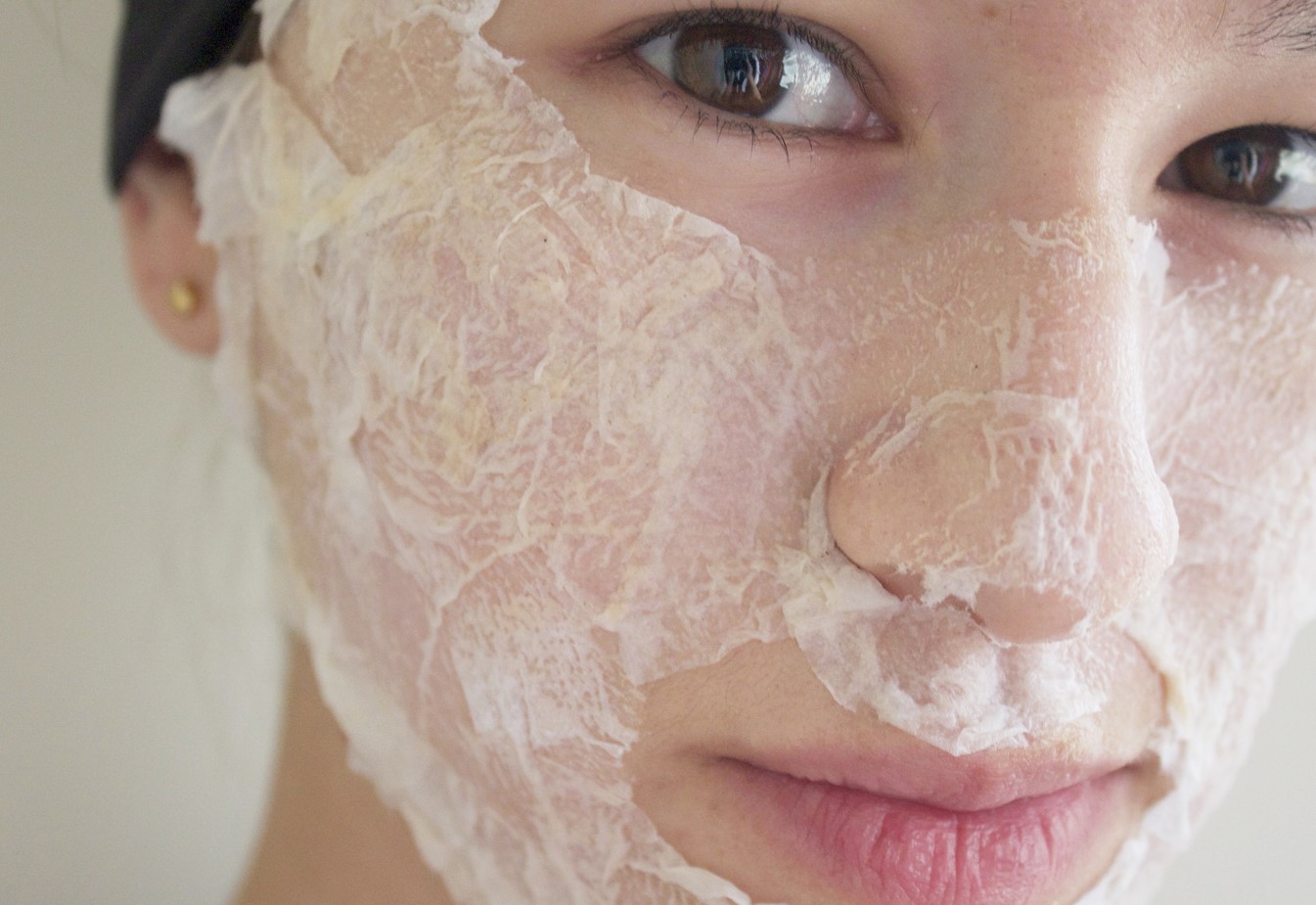 ماسک سفیده تخم مرغ برای جوش و جای جوش