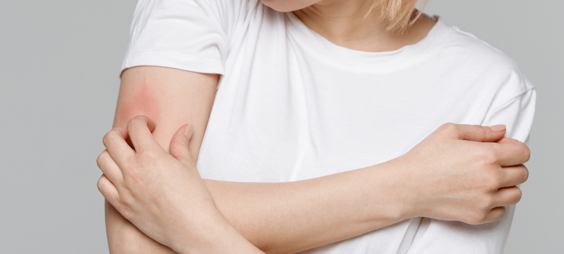 خارش دست - کمبود ویتامین و خارش پوست