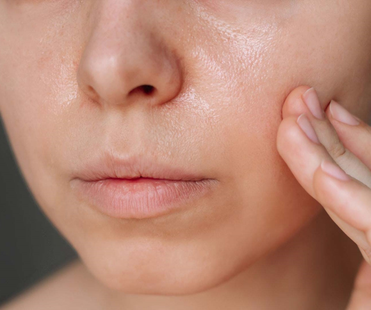 چربی تی زون - علت چرب شدن پوست صورت