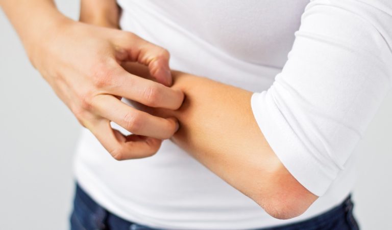 کمبود ویتامین و خارش پوست