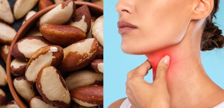 آجیل مناسب برای کم کاری تیروئید