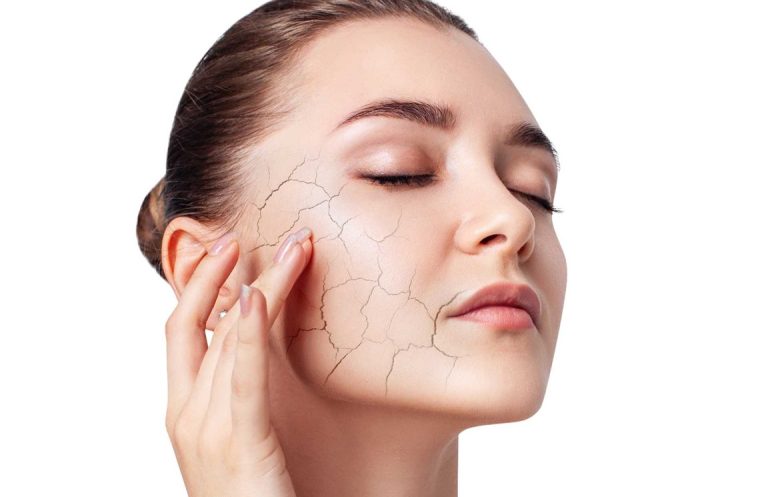 درمان سریع خشکی پوست