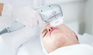 مهم ترین مراقبت های قبل از آن هایفوتراپی خط خنده