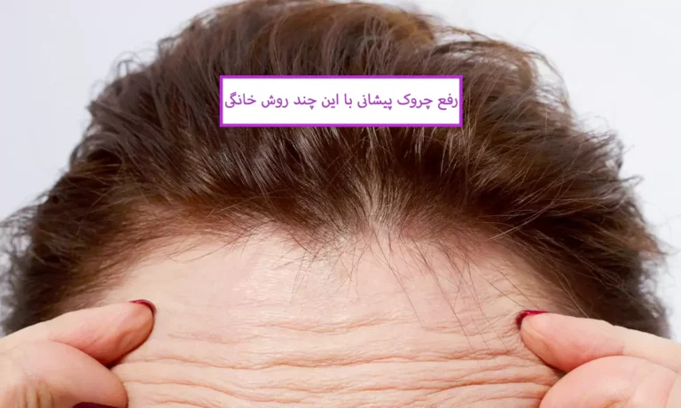 رفع چروک پیشانی با این چند روش خانگی