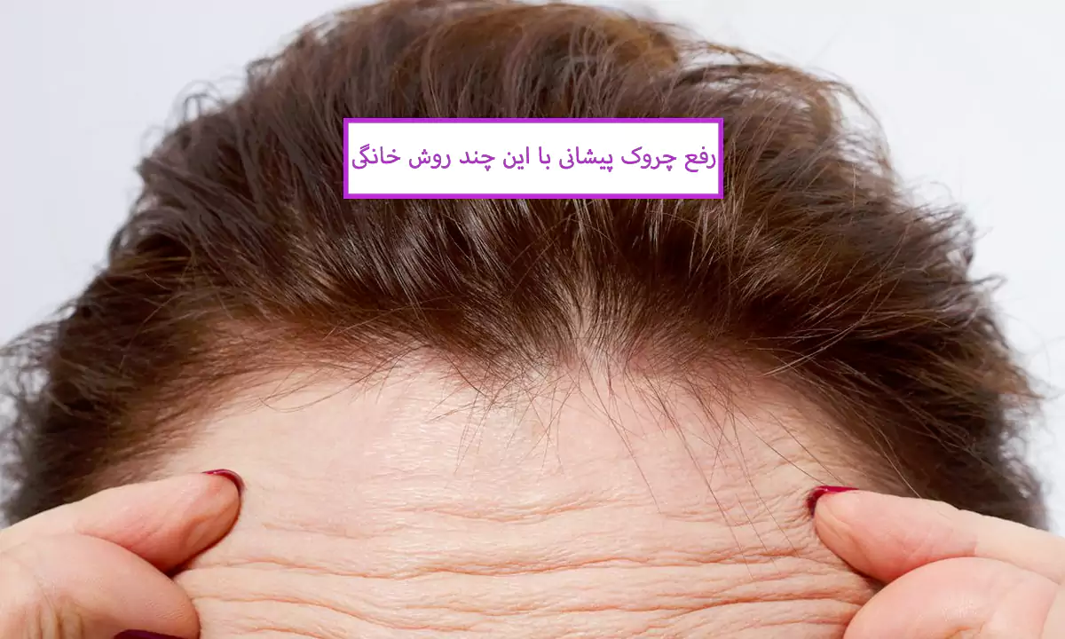 رفع چروک پیشانی با این چند روش خانگی