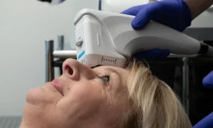 خانمی با سنبالای 50 سال در حال انجام هایفوتراپی صورت، بهترین کاندیدای هایفوتراپی چه افرادی هستند؟