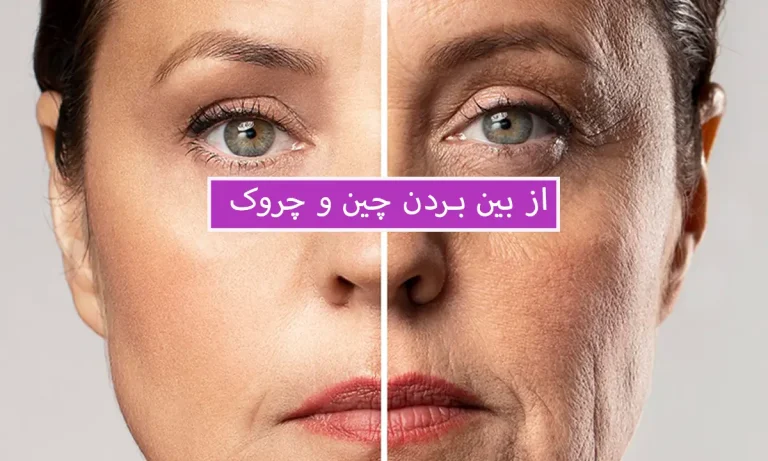 چگونه چروک صورت را از بین ببریم؟
