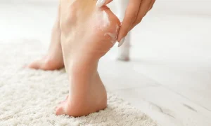 پماد ویتامین A و D برای ترک پا