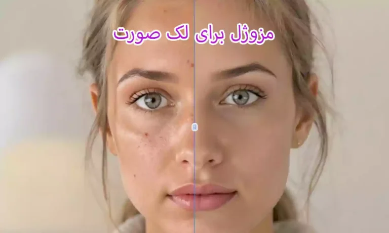 مزوژل برای لک صورت