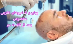 بهترین شامپوهای خارجی مخصوص بعد از کاشت مو