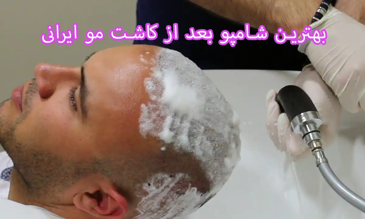شامپو بچه فیروز بعد از کاشت مو