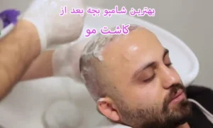 بهترین شامپو بعد از کاشت مو ایرانی