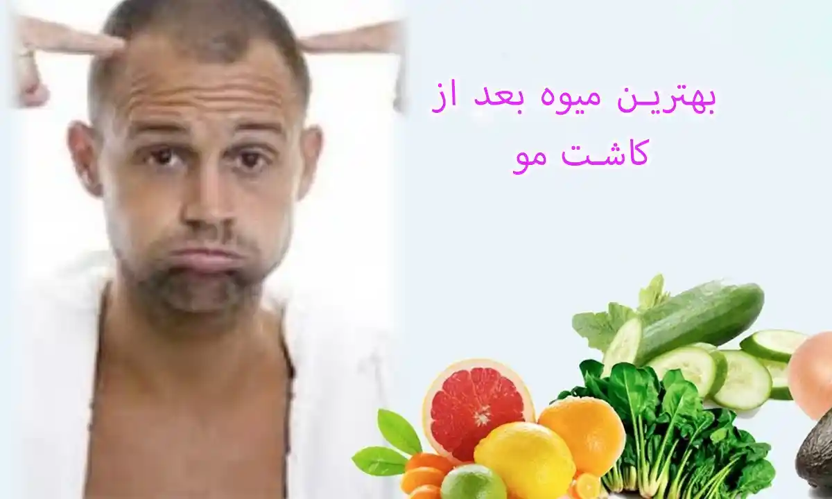 بهترین میوه بعد از کاشت مو