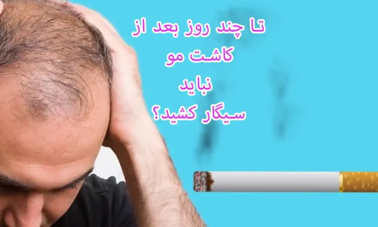 تا چند روز بعد از کاشت مو نباید سیگار کشید؟