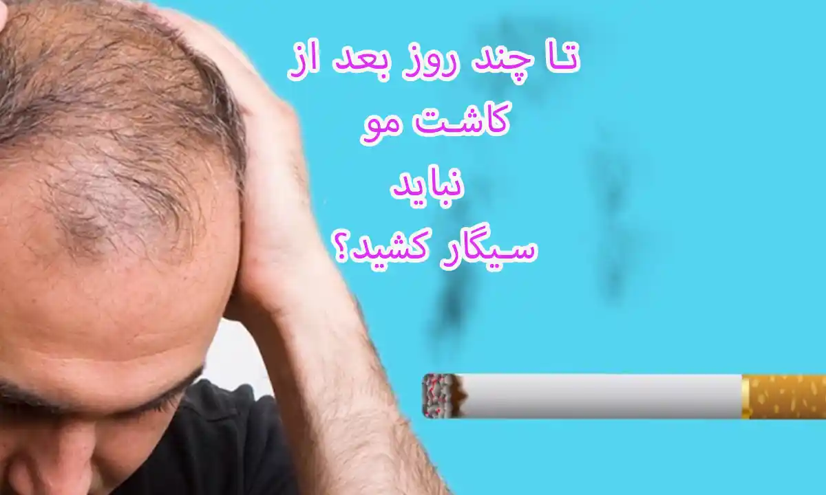 تا چند روز بعد از کاشت مو نباید سیگار کشید؟