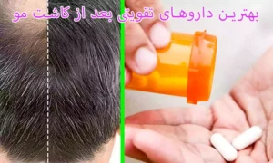 بهترین داروهای تقویتی بعد از کاشت مو کدامند؟