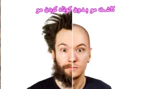 کاشت مو بدون کوتاه کردن مو