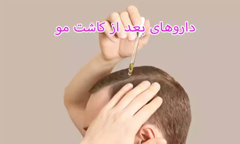 داروهای بعد از کاشت مو
