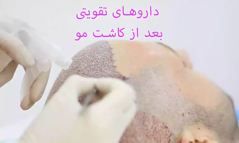 داروهای تقویتی بعد از کاشت مو