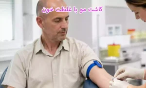 غلظت خون و کاشت مو، کاشت مو با غلظت خون