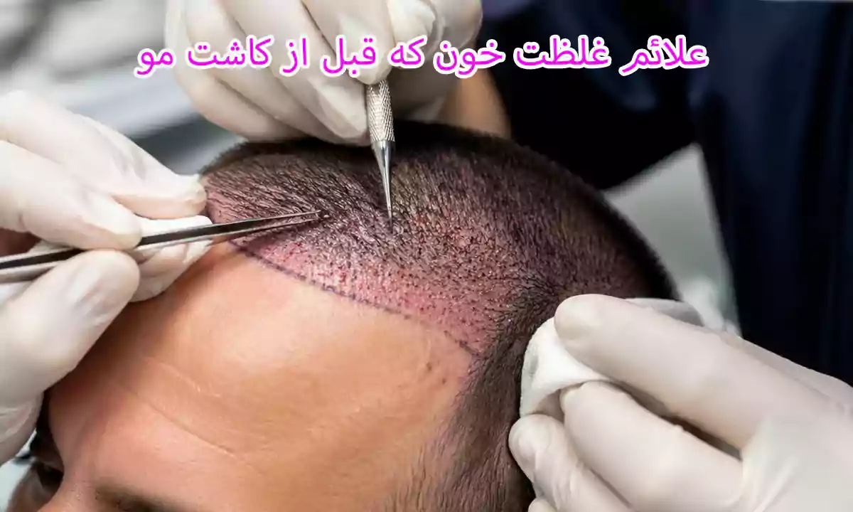 علائم غلظت خون که قبل از کاشت مو باید جدی بگیرید