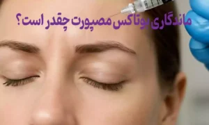 ماندگاری بوتاکس مصپورت چقدر است؟