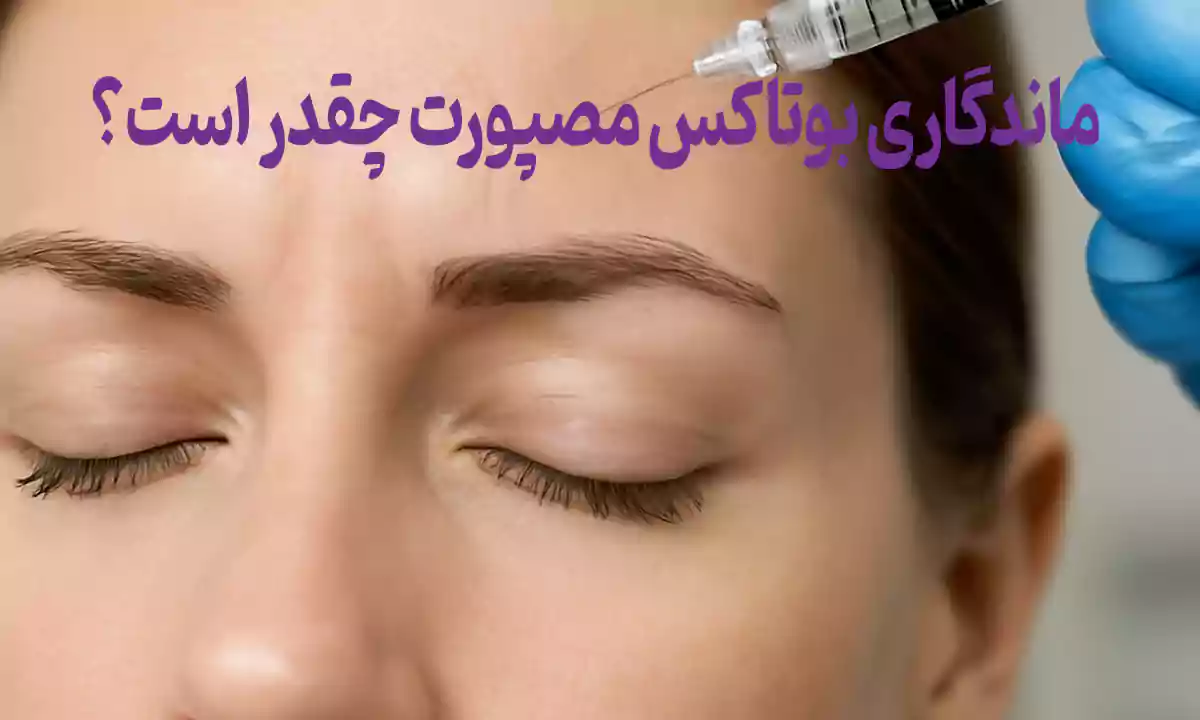 ماندگاری بوتاکس مصپورت چقدر است؟