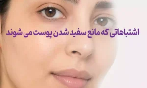 اشتباهاتی که مانع سفید شدن پوست می شوند