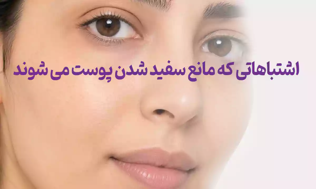 اشتباهاتی که مانع سفید شدن پوست می شوند