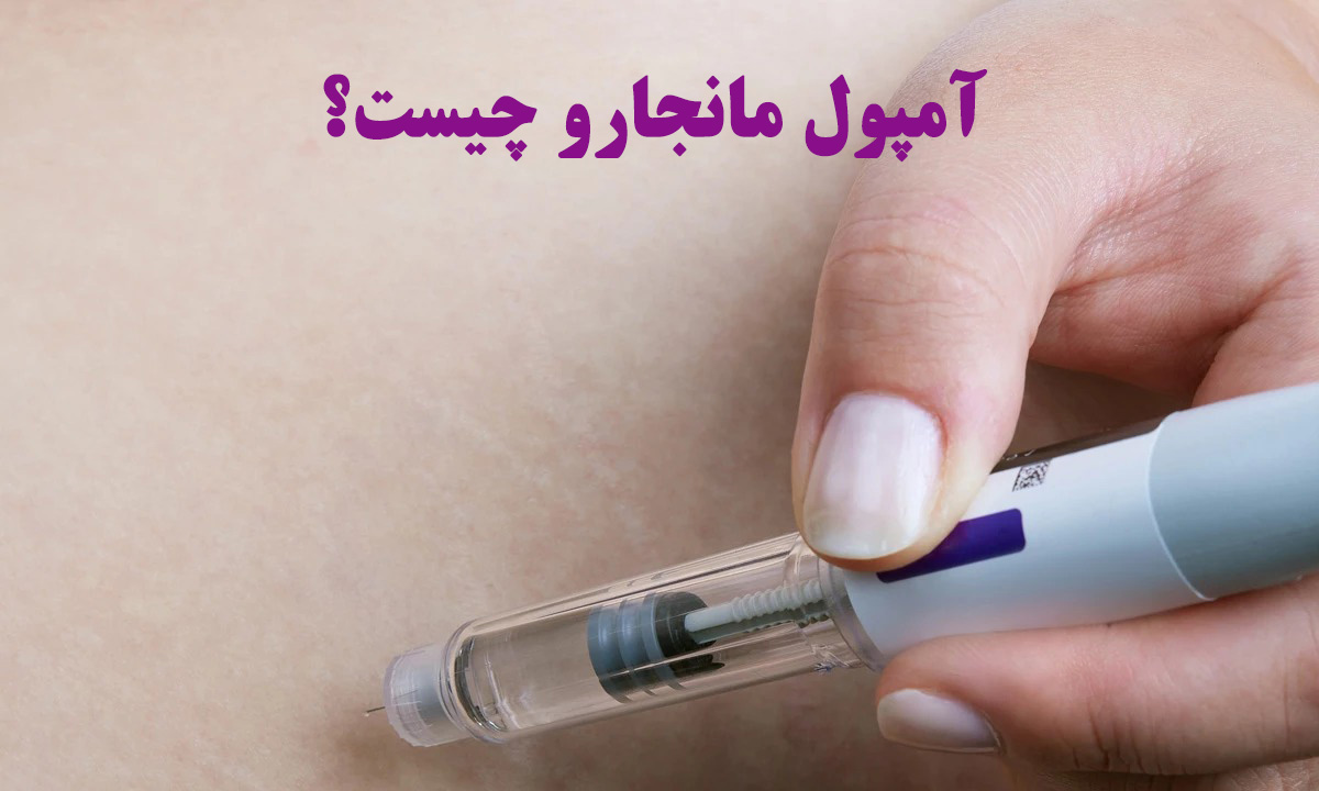 نحوه عملکرد مانجارو