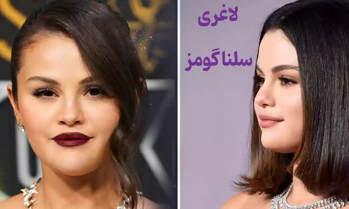 علت اصلی لاغری شدید بین هالیوودی ها چیست؟ لاغری سلنا گومز