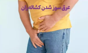 10مورد از بهترین پماد برای عرق سوز شدن کشاله ران