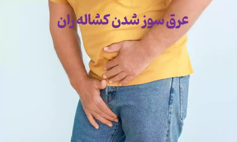 10مورد از بهترین پماد برای عرق سوز شدن کشاله ران