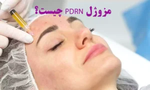 مزوژل pdrn چیست؟ راز جوانی پوست با تزریق ماهی سالمون به صورت