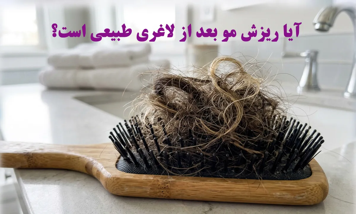 آیا ریزش مو بعد از لاغری طبیعی است؟