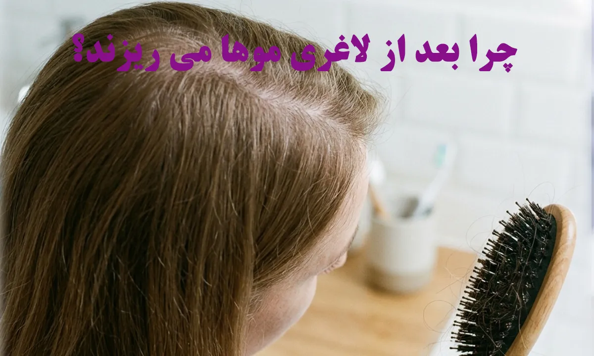 چرا بعد از لاغری موها می ریزند؟