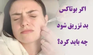 اگر بوتاکس بد تزریق شود چه باید کرد؟