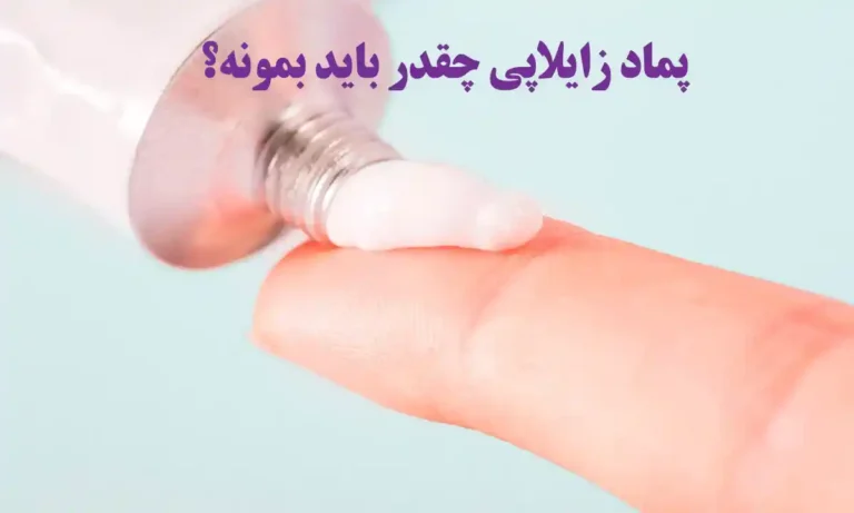 پماد زایلاپی چقدر باید بمونه؟