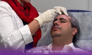 تزریق بوتاکس