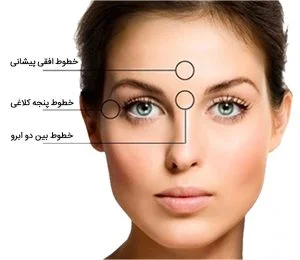 پاسخ به همه سوالات بوتاکس و انواع مختلف آن