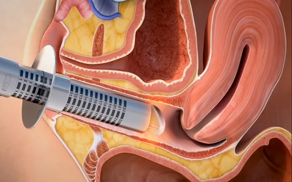 دستگاه مونالیزا جوانسازی واژن