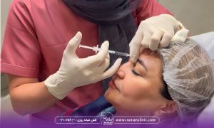 کاربرد بوتاکس