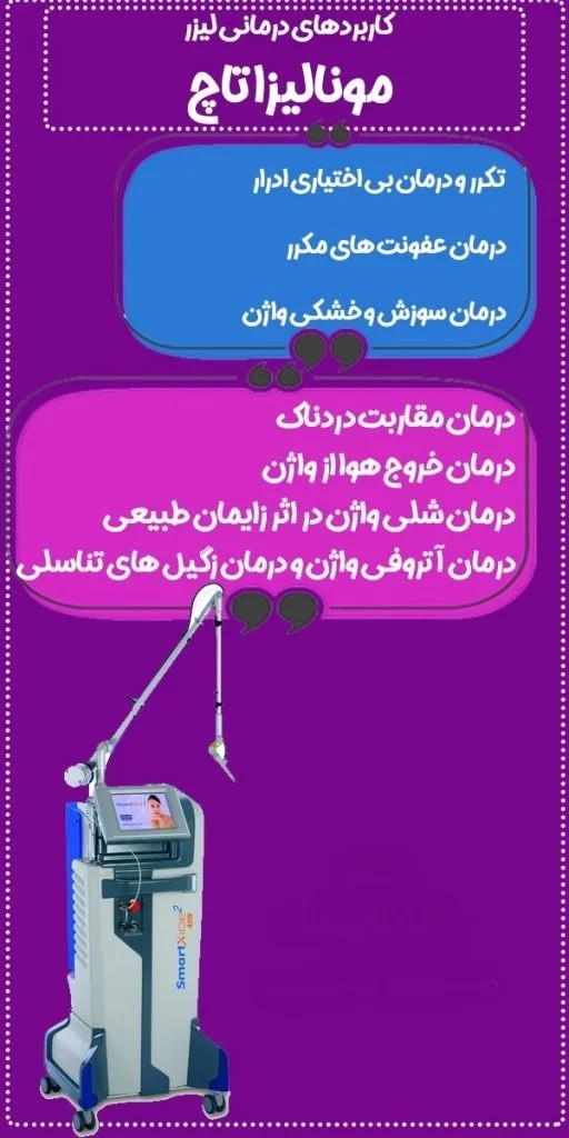 لیزر مونالیزاتاچ