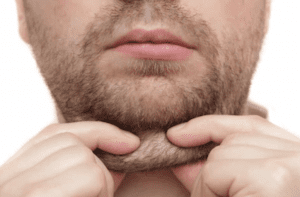 Double+Chin+treatment+for+men